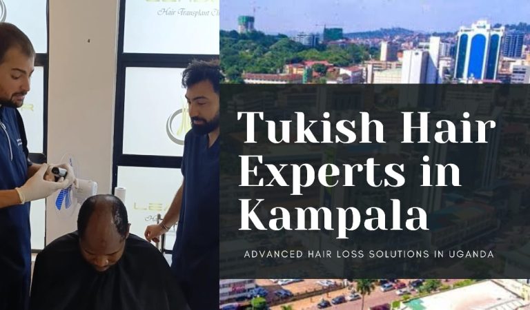 UGANDA WELCOMES TURKISH HAIR EXPERTS WITH AFFORDABLE, PAINLESS HAIR TRANSPLANTS IN KAMPALA UGANDA WELCOMES TURKISH HAIR EXPERTS WITH AFFORDABLE, PAINLESS HAIR TRANSPLANTS IN KAMPALA